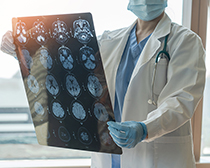 Ärztin betrachtet MRT-Aufnahmen vom Hirn