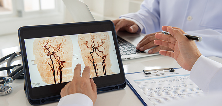 Arzt wertet Aufnahme von Blutgefäßen im Gehirn auf einem Tablet aus (Foto: shutterstock / create jobs 51)